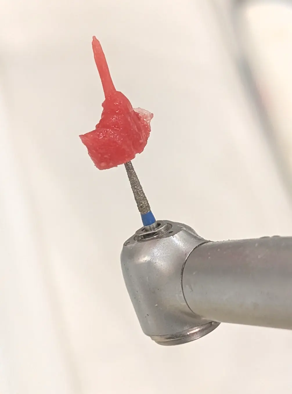 گیر کردن پست و کور دندان