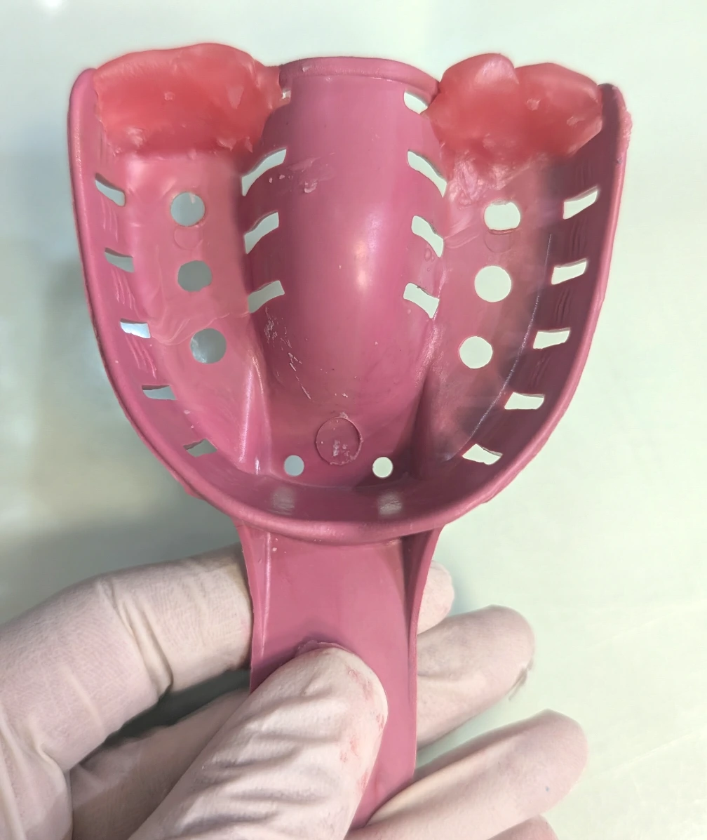 کنترل جریان ماده قالب‌گیری با ایجاد سد مومی در انتهای تری