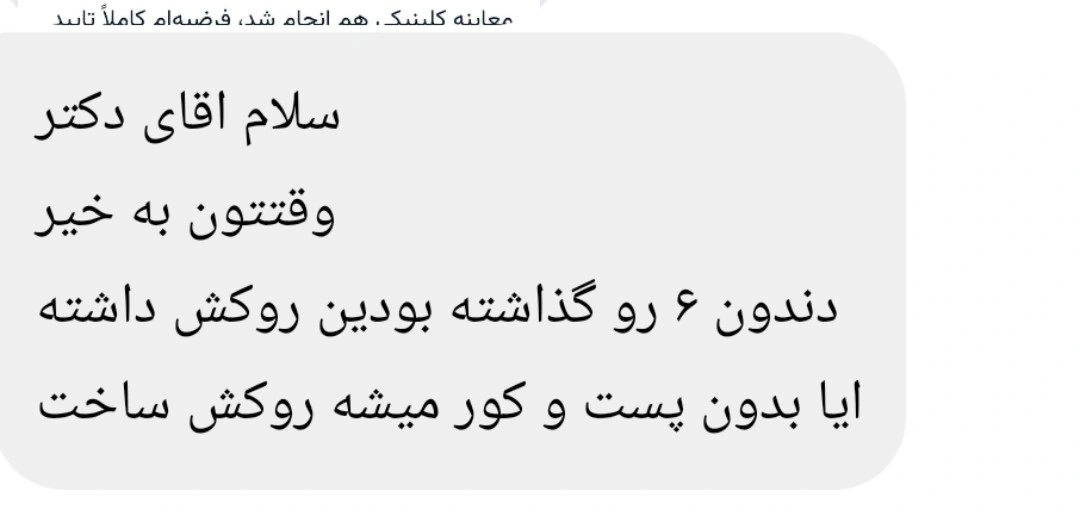 پیام دریافتی از یک دندان‌پزشک: برای دندان ۶ که برای روکش تراش خورده، آیا بدون پست و کور می‌شود روکش ساخت؟